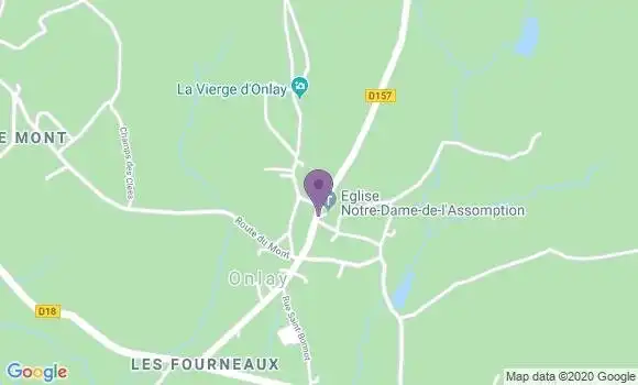 Localisation Onlay Ap - 58370